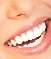 Homemade Teeth Whitening