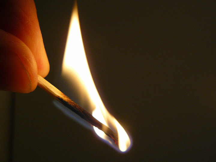 burnt%20fingers.jpg
