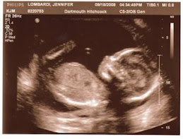 20 week bean