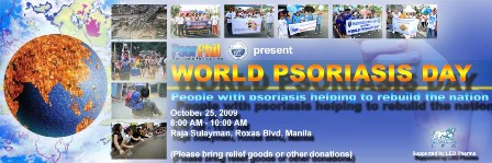 Can Psoriasis Spread