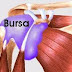 10 maneiras de lidar com a bursite