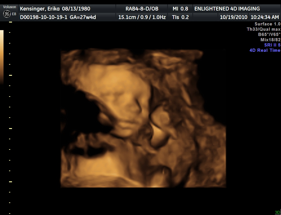 3d ultrasound pictures at 26 weeks. 3d Ultrasound we did @ 26