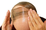 Indonesian easy recipes for several important factors that are contributing to your hair loss