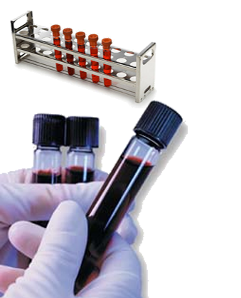 Exame de sangue detecta drogas