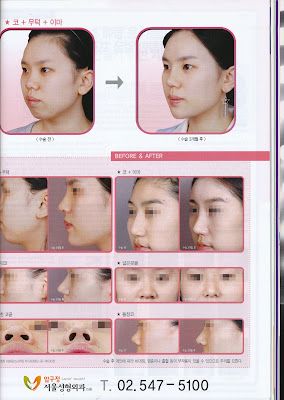 Korean Plastic Surgery on Faster Zombies  Plastic Surgery In Korea  Before And After