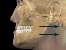 Ortodontia e Cirurgia