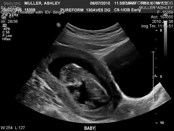 Baby at 12 weeks 5 days!