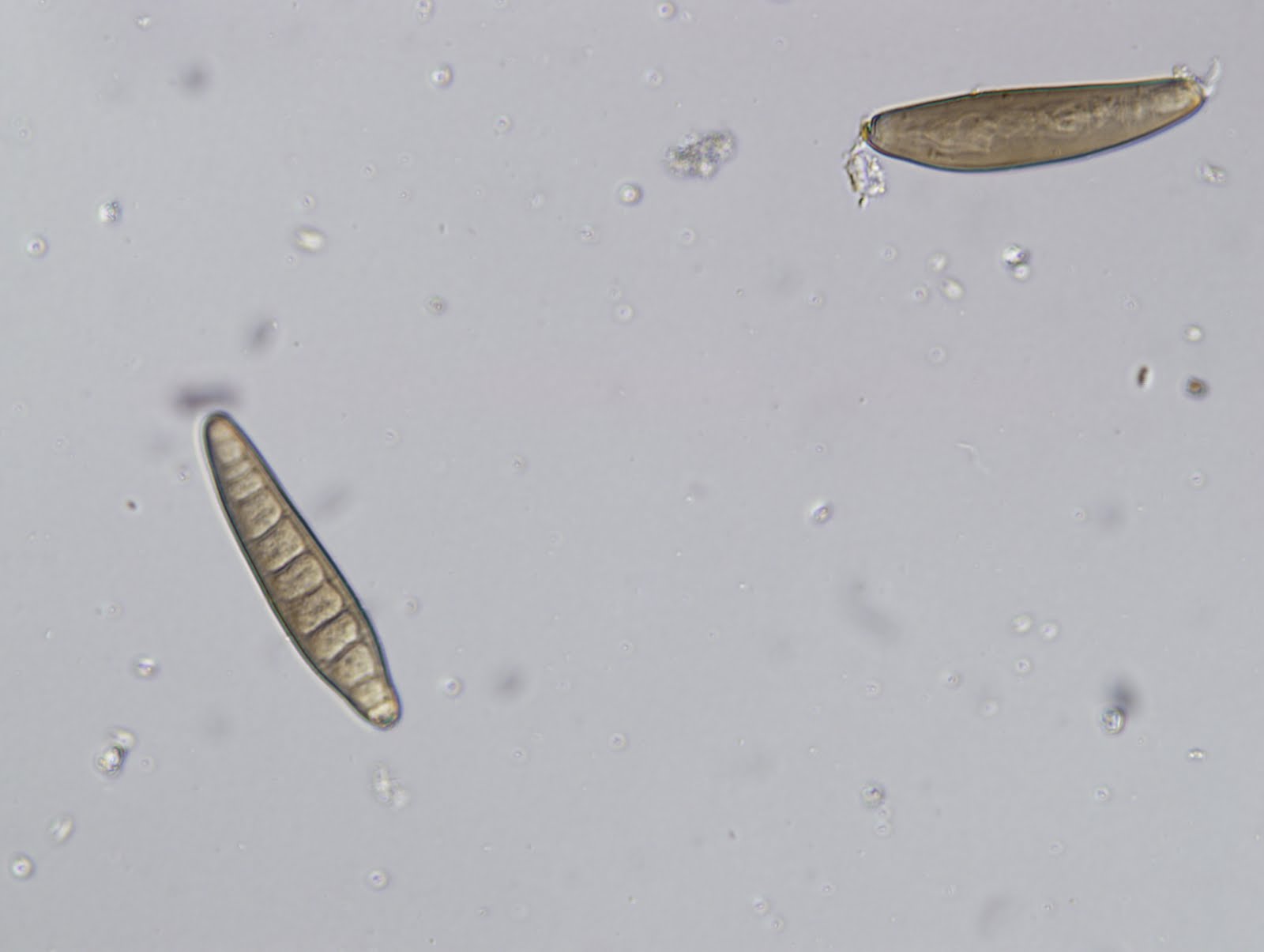 Bipolaris Species