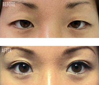 Makeup to make eyes bigger before and after Makeup to make eyes bigger before and after