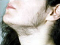 [Face+Com+barba.jpg]