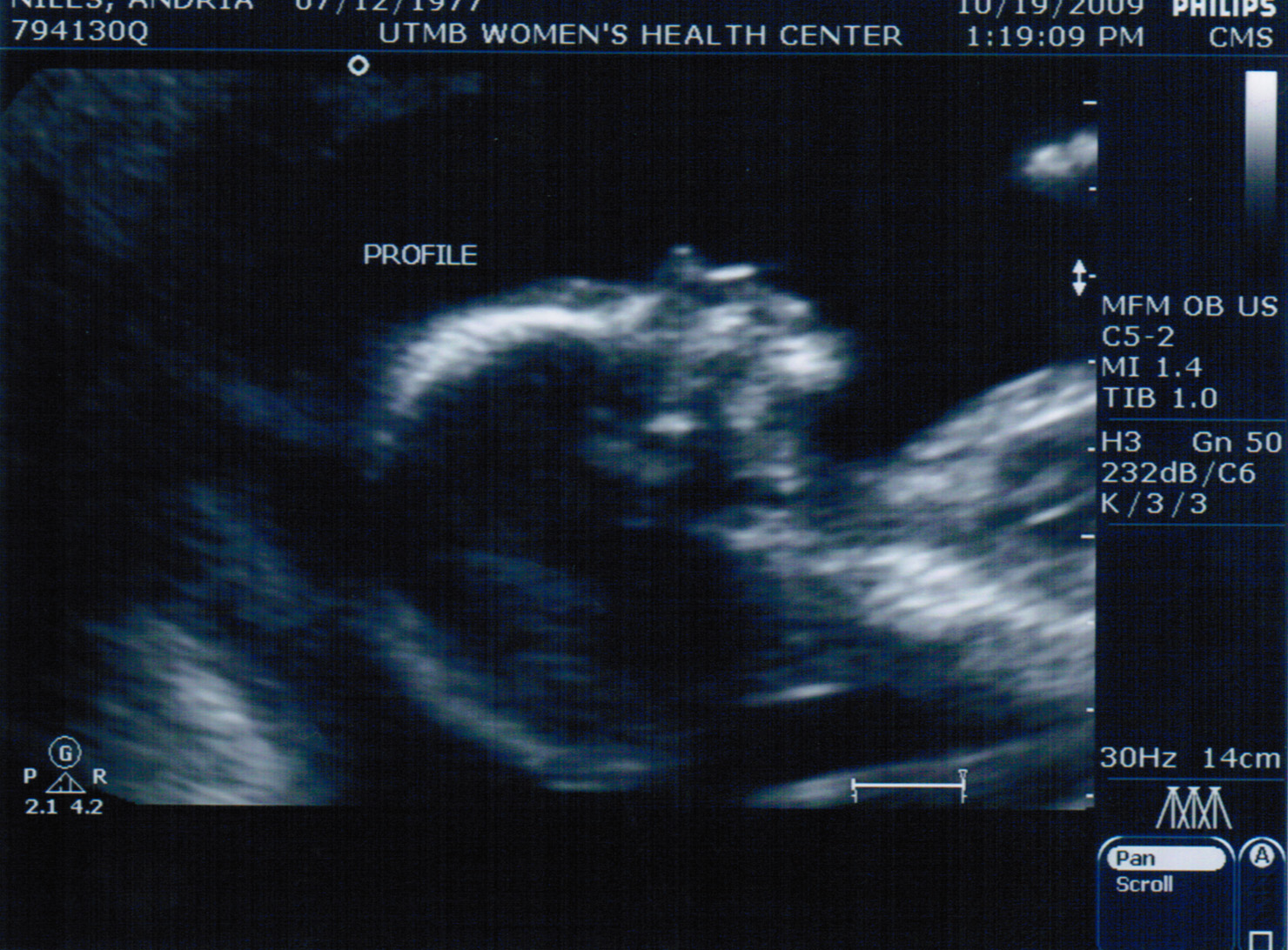 [ultrasound+profile.jpg]