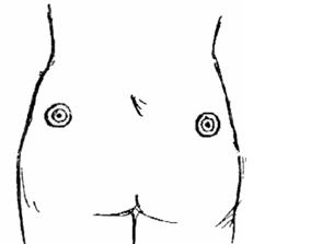 Hcg 10000 units injectable online