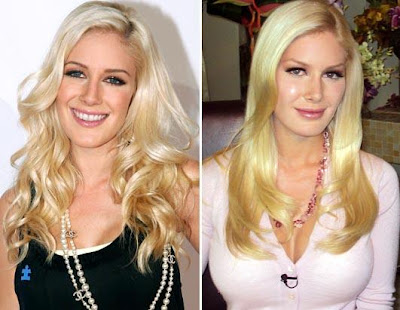 pictures of lady gaga before plastic surgery. heidi montag plastic surgery