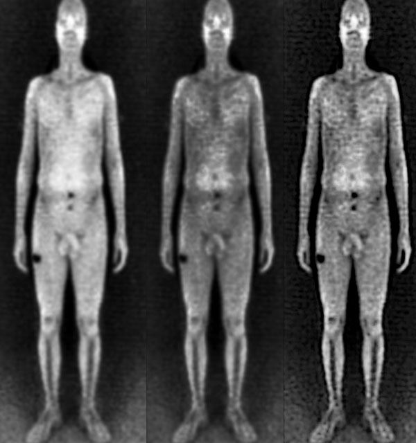 airport x ray nude Airport x ray nude