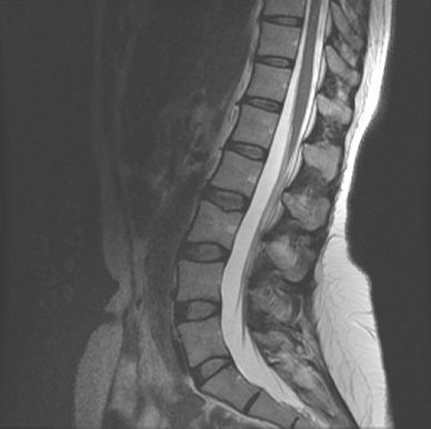 [lumbar+spine.gif]