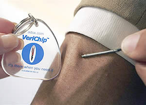 [chip2.jpg]