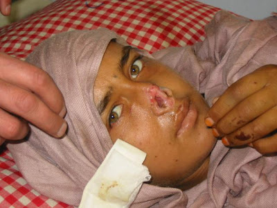 woman mutilated by her husband for reportedly committing adultery he woman mutilated by her husband for reportedly committing adultery he