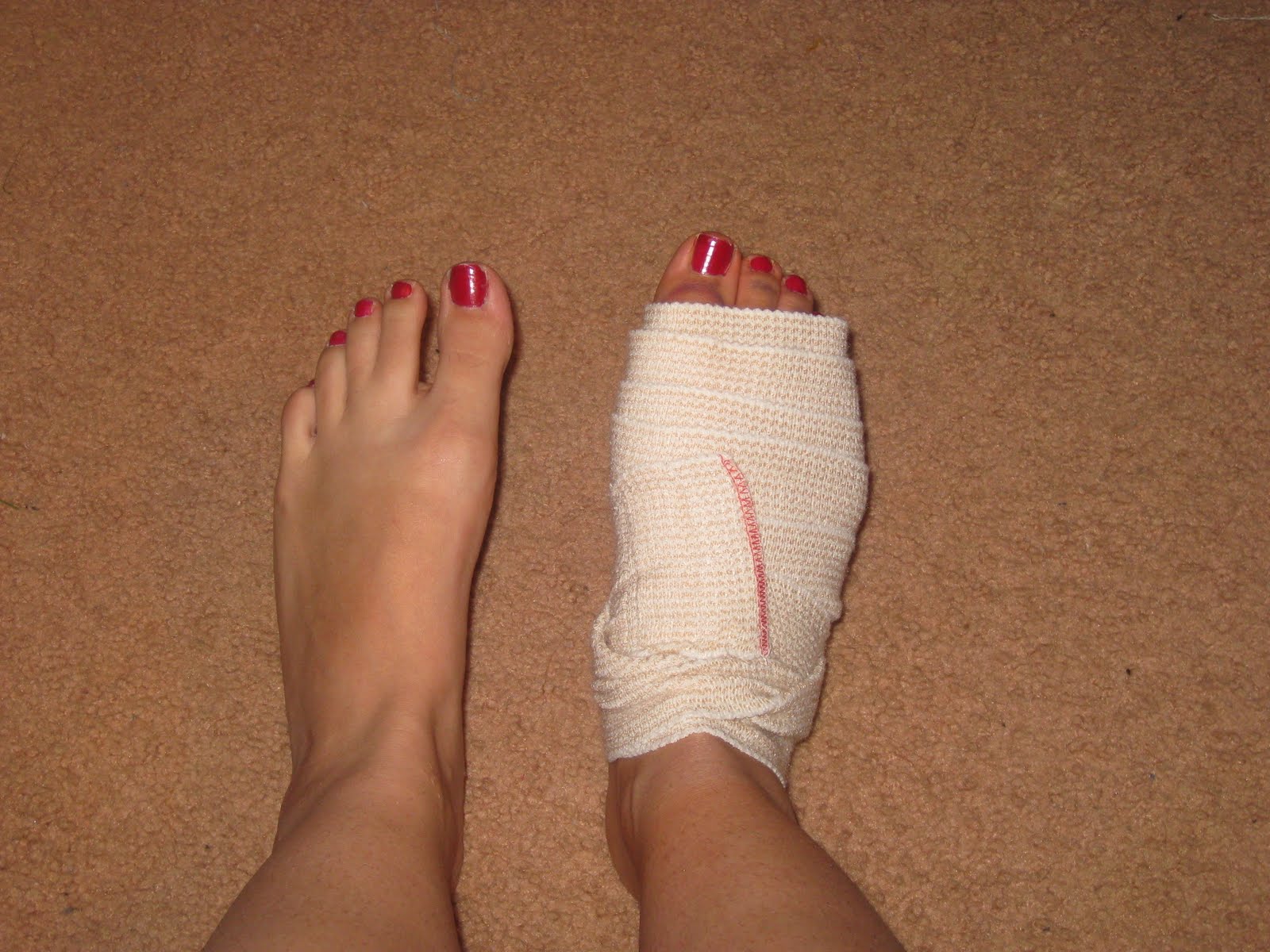 AmyluvsTrees Bunion Funion