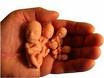 Praktik Aborsi Berkedok Penyedia Obat Terlambat Bulan Pernah Dikupas Praktik Aborsi Berkedok Penyedia Obat Terlambat Bulan Pernah Dikupas