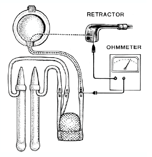 Penile Implants for Erectile Dysfunction
