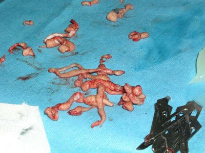 Horrible tattoo creations