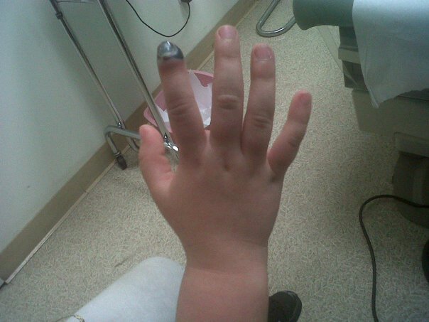Metallman S Reverie Blood Shed And A Smashed Finger