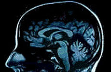 [brain3.jpg]