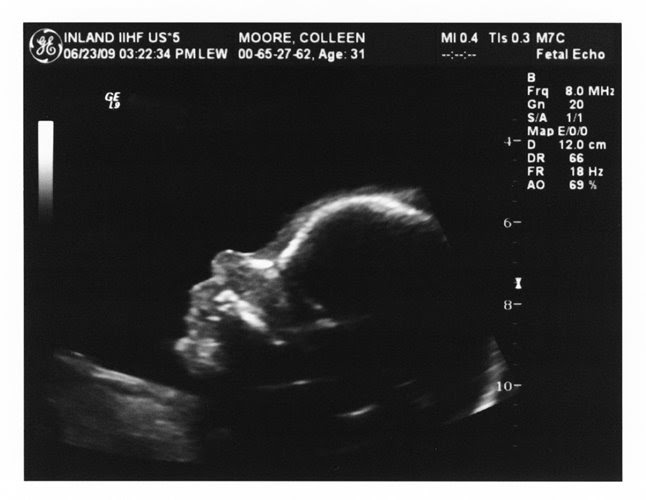 Baby Moore Blog 24 Week Ultrasound (6 Months)
