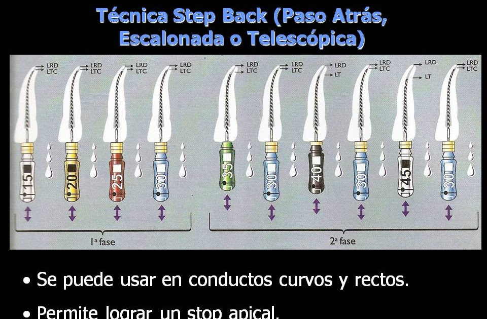 Endodoncia PREPARACION BIOMECANICA