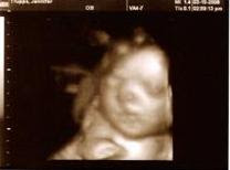 26 week baby 3D