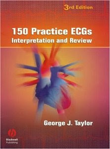 150 Practice ECGs. Interpretation and Review. 3rd Ed.