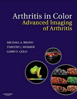 Arthritis in Color: Advanced Imaging of Arthritis