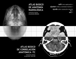 Atlas Correlacion Anatomia -- Rx -- TAC