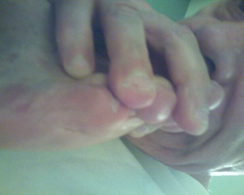 Biting Toenails