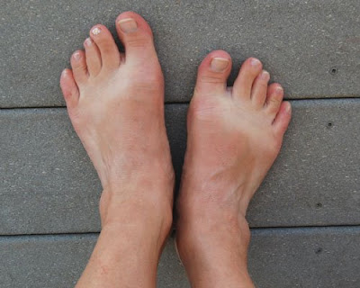 wide feet women