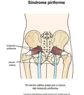 Daño al nervio ciático ,porque duele tanto ? Daño al nervio ciático ,porque duele tanto ?