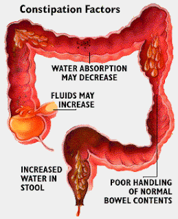 has diarrhea with mucus blood mucus diarrhea in adults maintaining troops cf has diarrhea with mucus blood mucus diarrhea in adults maintaining troops cf