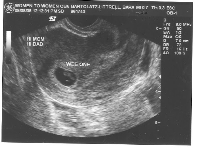 Ultrasound 090808