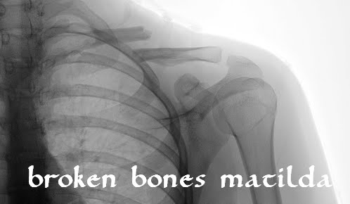 Broken Bones Matilda.