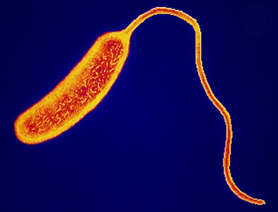 Bacterias: VIBRIONES