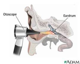 otoscope & eardrum