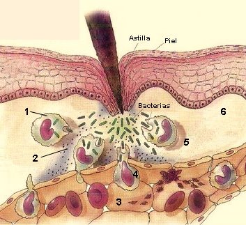 [inflamatoria-muda.jpg]