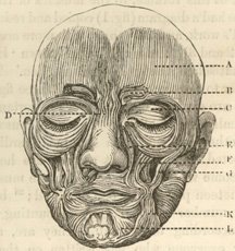 [Facial_Muscles.jpg]