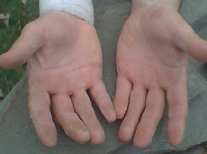 Callused Hands