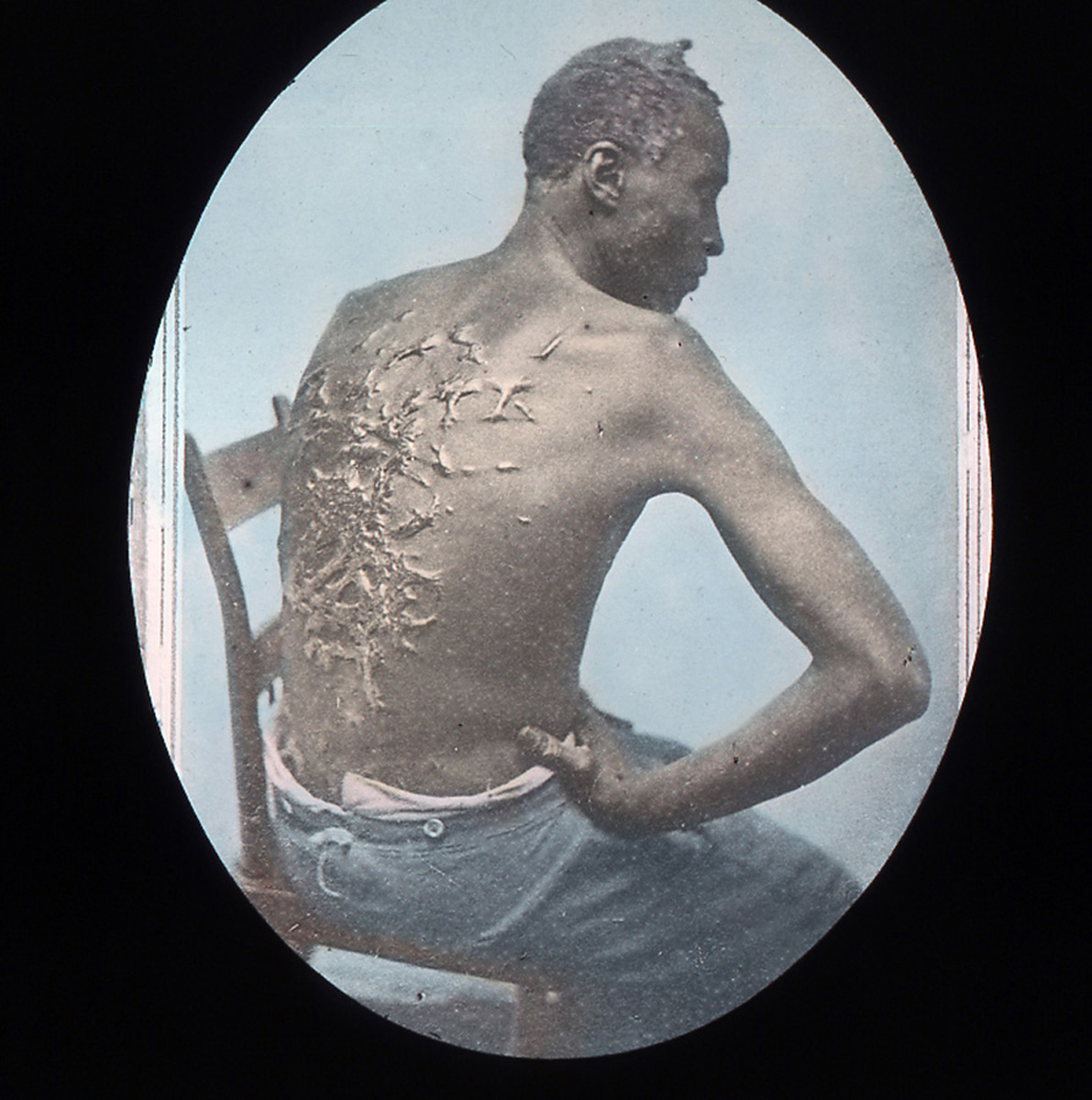 [The+scourged+back.jpg]