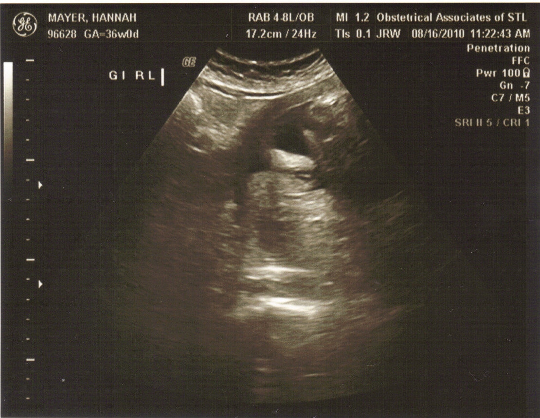 30 week ultrasound picture