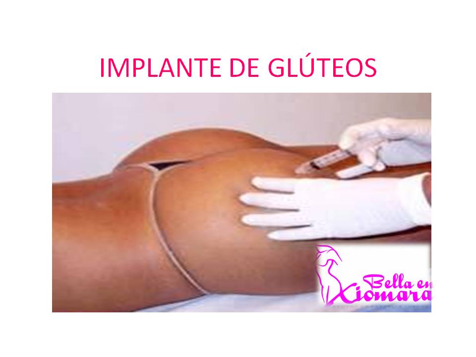 IMPLANTE GLUTEOS implante gluteos:
