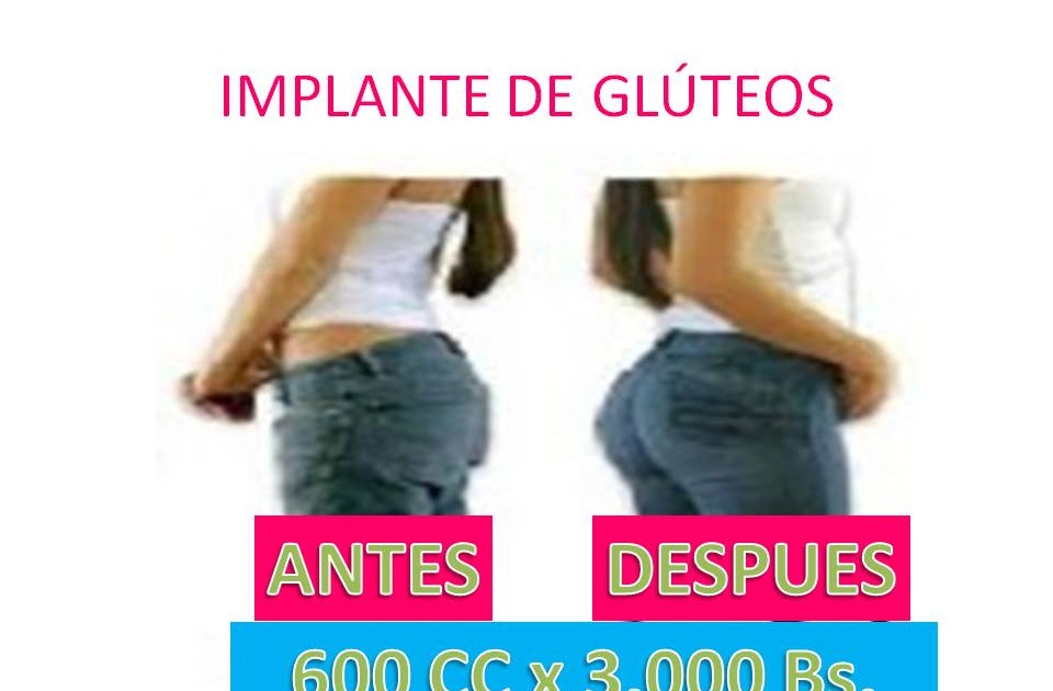 BELLA EN XIOMARA: IMPLANTE DE GLÚTEOS