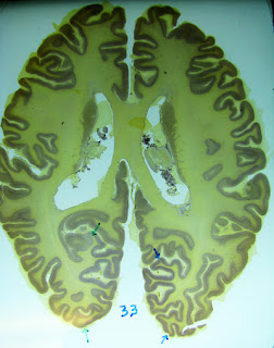 Cerebro de un humano adulto. Foto: SINC