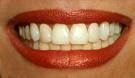 Dental Care Tips